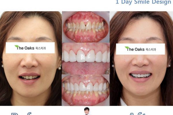 11 seoul guide medical dental patients (14)