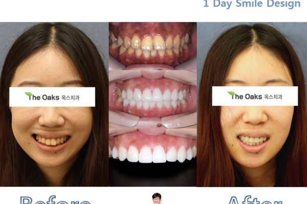 11 seoul guide medical dental patients (15)