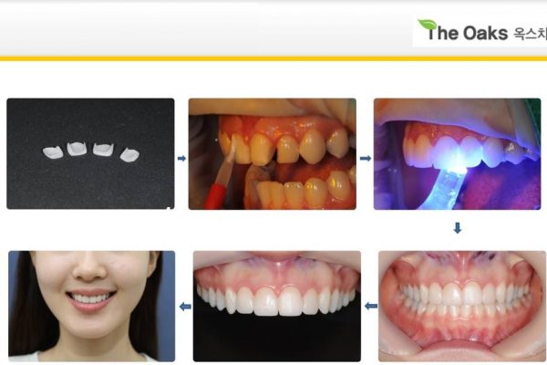 11 seoul guide medical dental patients (28)