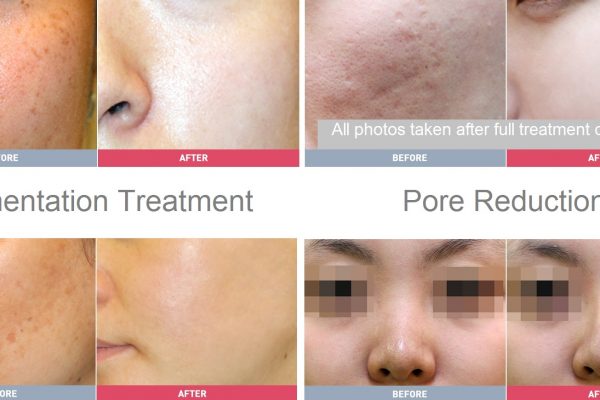 16 skin care before and after variety