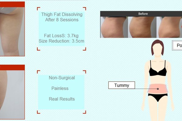18 skin care before and after fat dissolving seoul guide medical