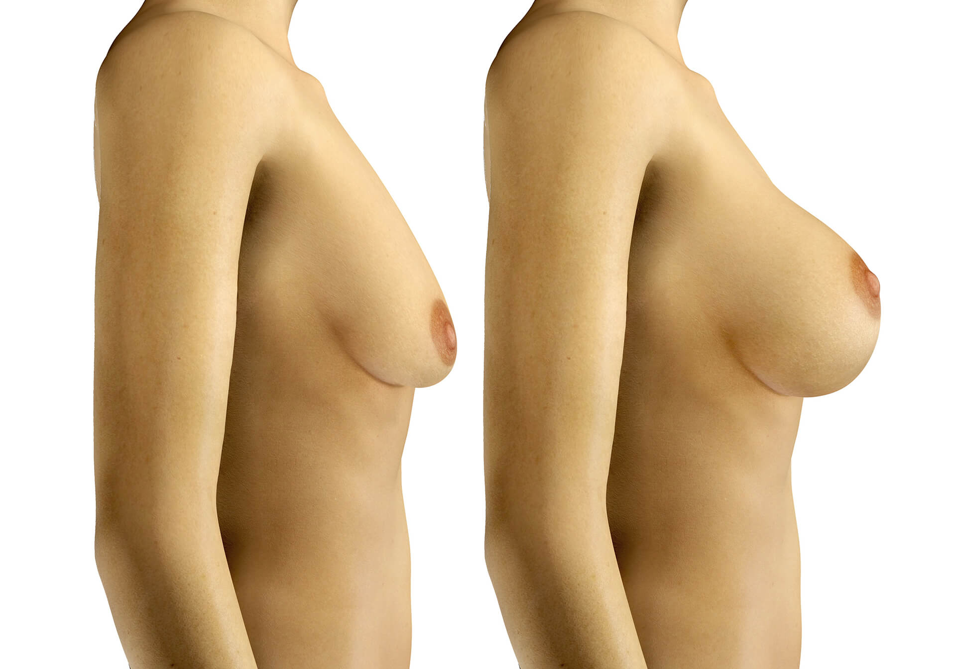 как выглядит здоровая грудь у женщин фото 96