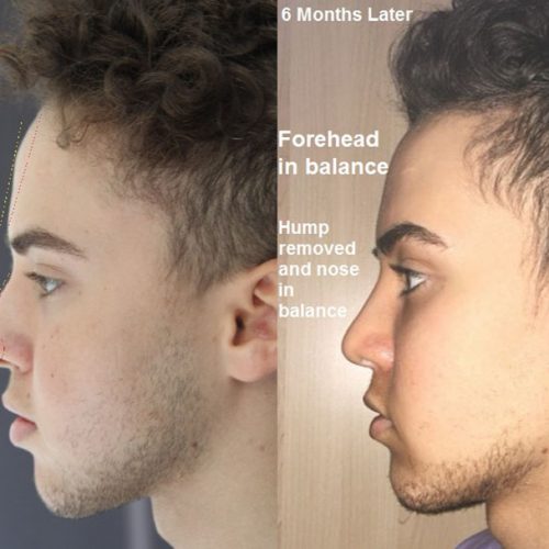Timothy Wehbe Seoul Guide Medical Plastic Surgery