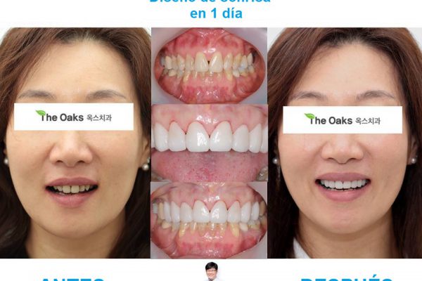 11-seoul-guide-medical-dental-patients-14