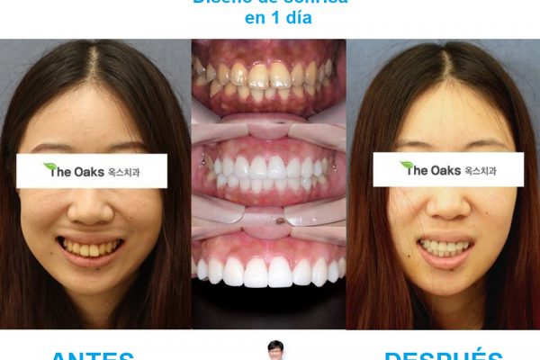 11-seoul-guide-medical-dental-patients-15