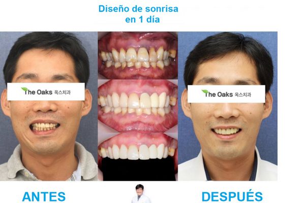 11-seoul-guide-medical-dental-patients-16