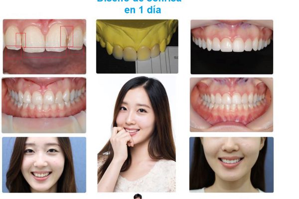 11-seoul-guide-medical-dental-patients-43