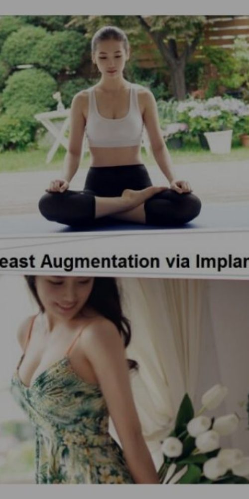 Breast Augmentation Incision Types in korea