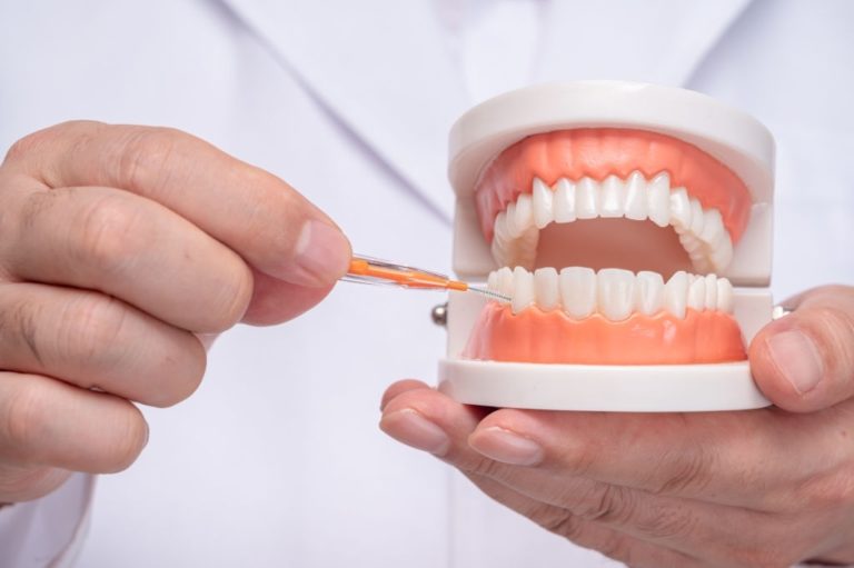 Dental Treatment in Korea in 2021 Seoul Guide Medical