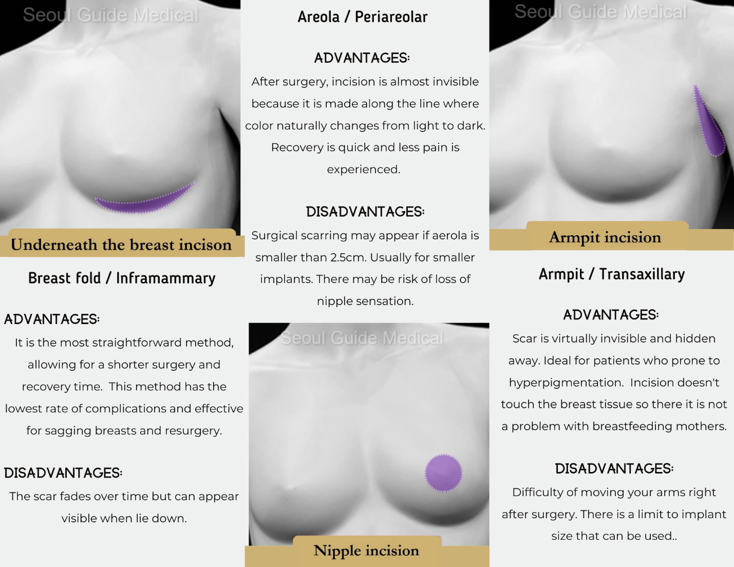 The Guide to Breast Implant Shapes & Sizes